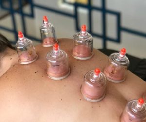 Ventosaterapia-2-768x448-1